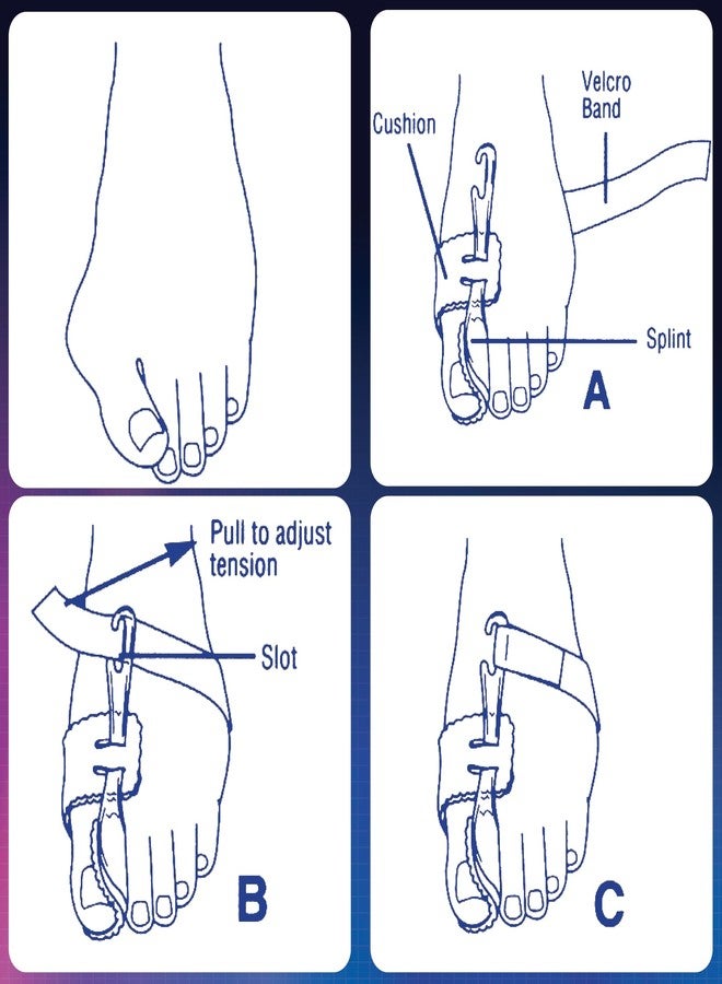 PediFix Nighttime Bunion Regulator, Right Foot, Medium - Image 4